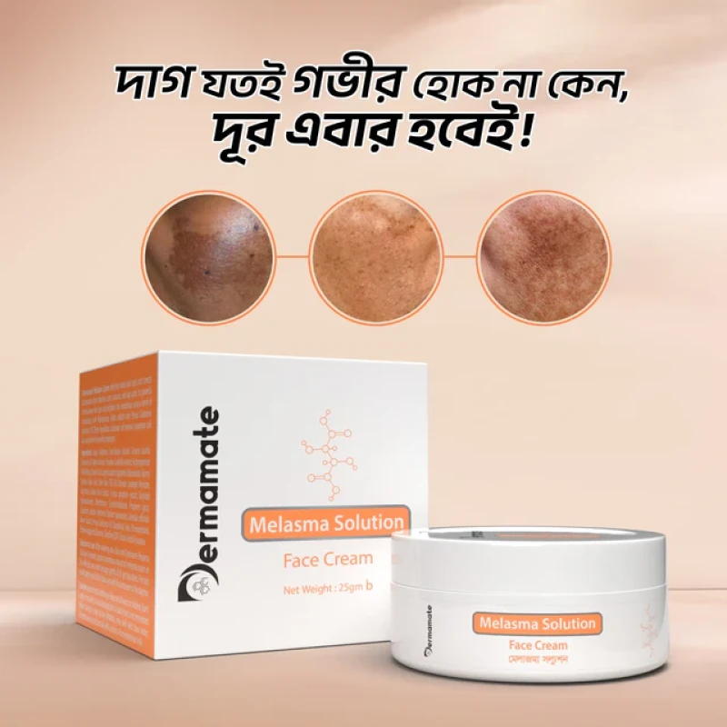 Dermamate Melasma Solution Face Cream - 25g